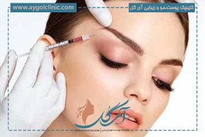 مزوتراپی ابرو: راهکاری جدید برای تقویت و پرپشت کردن ابروها