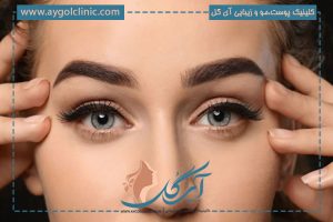 آشنایی با مزایا و معایب کاشت ابرو: هر آنچه باید بدانید