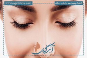 کاشت ابرو برای چه کسانی ضرر دارد؟