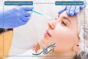 فیلر بینی برای چه کسانی مناسب است؟ بررسی کامل مزایا و معایب