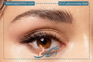 مدل کاشت ابروی نچرال: جلوه‌ای طبییعی در چهره + ماندگاری و مزایا