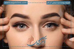 ماندگاری کاشت ابرو چقدر است؟ عوامل موثر + 5 راه طلایی افزایش آن