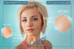 آیا لیزر باعث تیرگی پوست می‌شود؟ بررسی کامل اثرات لیزر بر پوست