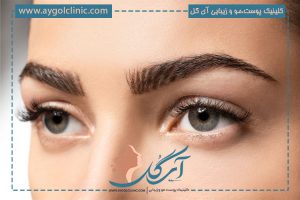تفاوت کاشت ابرو با تاتو چیست؟ مزایا و معایب هر کدام را بشناسید