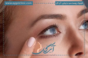 جوانسازی زیر چشم: بهترین روش‌ها و تکنیک‌های بهبود پوست