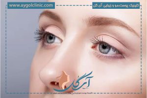 عوارض بلفاروپلاستی: بررسی کامل و نکات مهم برای بیماران