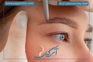کاشت ابرو با تراکم بالا و طبیعی + ماندگاری و مراقبت‌های مهم آن