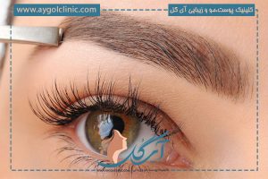 بهترین روش کاشت ابرو چیست؟ + راهنمای جامع و مقایسه انواع روش‌ها