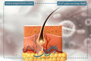 فولیکول مو چست و چگونه از بین می‌رود؟ به همراه راهکارهای تقویتی