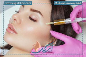 پی آر پی صورت چیست؟ به همراه مزایا و چگونگی انجام آن