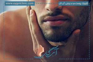 کاشت ریش و سبیل؛ راهنمای کامل از روش‌ها تا مراقبت‌های بعد از عمل