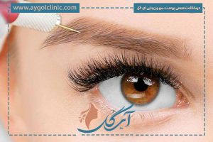 بهترین زمان مزوتراپی بعد از کاشت ابرو همراه با هزینه‌ها