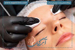 دلایل ایجاد جای زخم کاشت ابرو ، نحوه مراقبت و راههای درمان