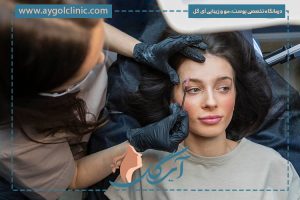 دلایل ایجاد جوش ابرو بعد از کاشت ابرو ، راه‌های پیشگیری و درمان