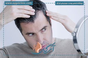 روش‌های نوین و مؤثر برای درمان سریع ریزش مو در مردان و زنان