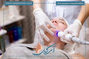 لیزر موهای سفید چانه با دستگاه الکترولیز به همراه نکات مهم!