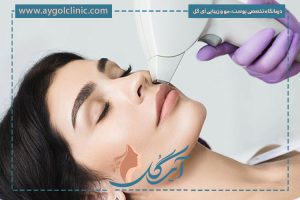 آیا لیزر پشت لب درد دارد؟ بررسی قیمت و مدت زمان دوره آن