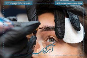 کاشت ابرو پهن دخترانه طبیعی [طراحی اختصاصی + کاندیدای مناسب]
