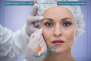 بهترین جراح پلک در تهران کیست؟ تجربه خوشایند جوانی چشم‌ها