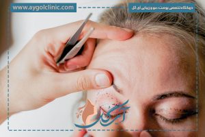 مزایای استفاده از وازلین برای افتادگی پلک را بشناسید!