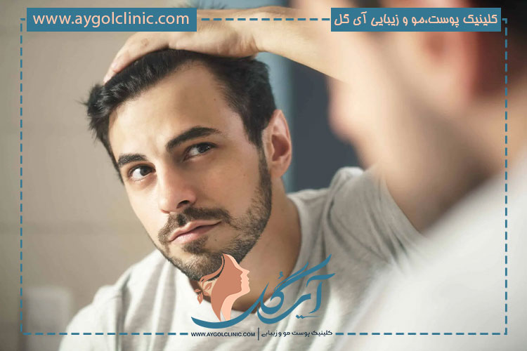 کاشت مو به روش SAFER یا اتوماتیک: راهکاری پیشرفته برای بازیابی مو