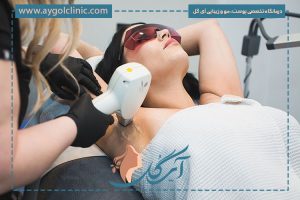 دستگاه لیزر SHR چیست و چه عملکردی دارد؟
