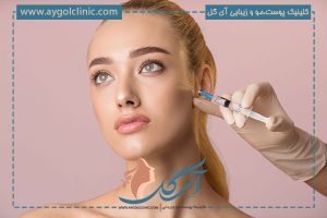 تزریق فیلر گونه چیست؟ همه چیز درباره تزریق فیلر گونه و مزایای آن