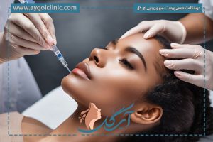 تزریق پروفایلو: کاربرد، مزایا، ماندگاری و هر آنچه باید بدانید!