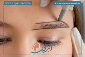 پشیمانی از کاشت ابرو؛ دلایل، راهکارها و روشهای جلوگیری