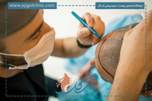 کاشت مو در شیراز بهتر است یا تهران؟ کدام شهر را انتخاب کنیم؟