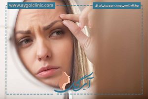 ریزش ابرو بعد از کاشت، چرا اتفاق می افتد و چه باید کرد؟