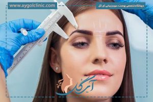 نتیجه کاشت ابرو بعد از سه ماه به همراه عوامل تاثیرگذار
