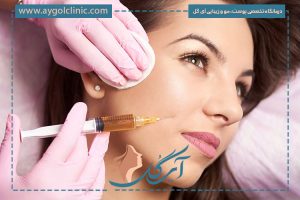 چند سی‌سی ژل برای خط خنده لازم است؟ مقدار، عوارض و ماندگاری