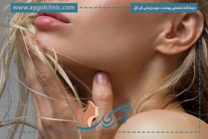 لیپوساکشن غبغب چیست؟ | راهنمای کامل، مزایا، عوارض و مراقبت‌ها