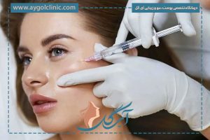 تزریق ژل گونه برای صورت کشیده + مزایا و مراقبت‌های قبل و بعد
