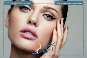 همه چیز درباره بوتاکس چشم گربه ای؛ مزایا، مراقبت و ماندگاری