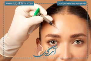 همه چیز درباره بوتاکس دیسپورت؛ مزایا، ماندگاری و مقایسه
