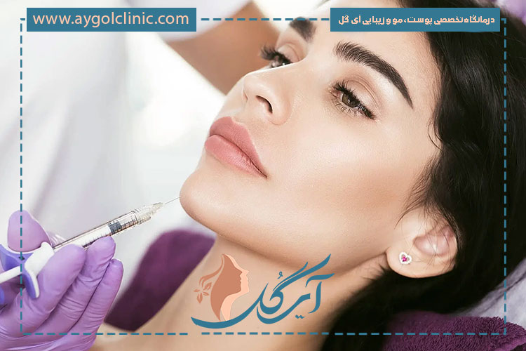 مراقبت های بعد از تزریق ژل چانه برای کاهش عوارض و افزایش ماندگاری نتایج