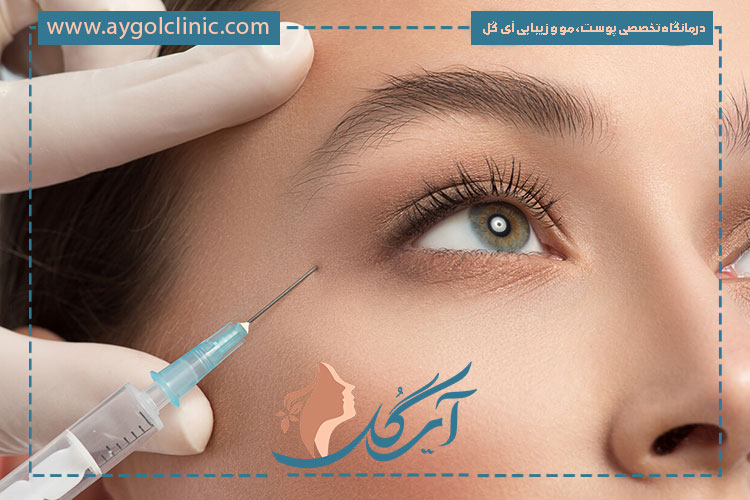 شناخت دقیق نقاط ممنوعه برای تزریق بوتاکس ابرو جهت جلوگیری از عوارض