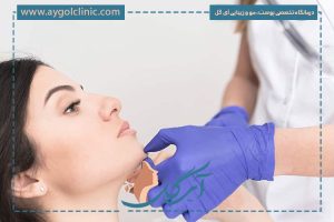 تزریق ژل چانه برای صورت گرد؛ زیبایی متناسب با فرم صورت