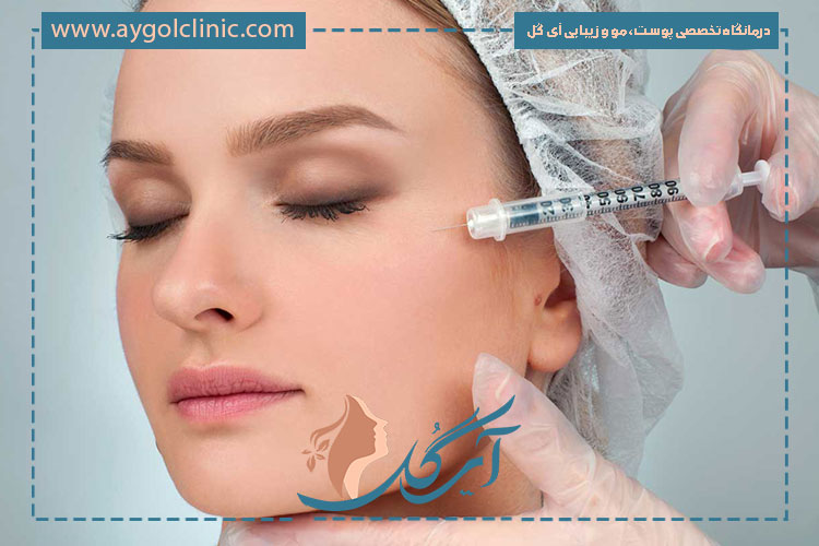 تزریق کات گونه چیست؟ تزریق فیلر در نواحی اطراف گونه برای ایجاد صورت استخوانی و کشیده