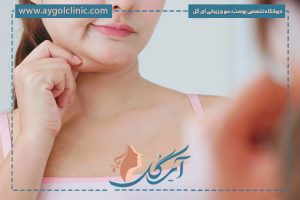 اندولیفت غبغب چیست و چگونه عمل می‌کند؟ + کاربردها و مزایای آن