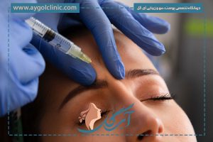 عوارض بوتاکس پیشانی و راهکارهای جلوگیری یا کاهش آنها چیست؟
