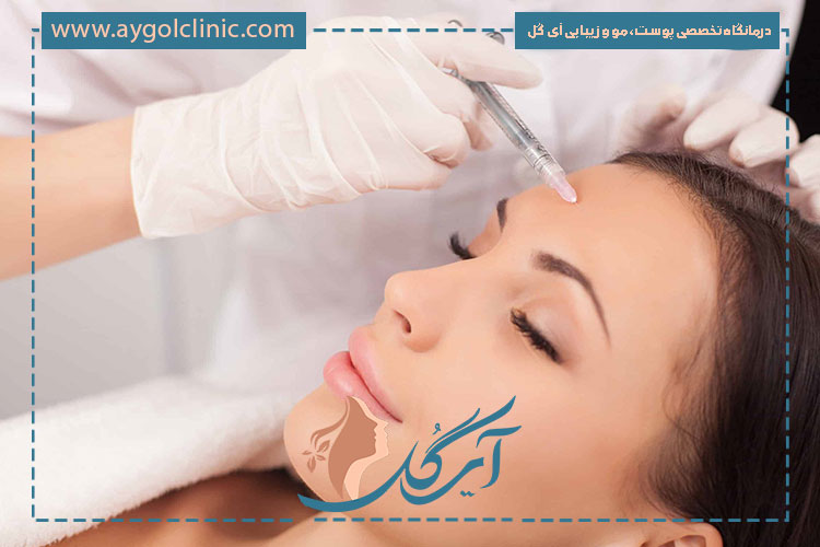 از لحاظ سرعت تاثیرگذاری و ماندگاری، بوتاکس نابوتا بهتره یا مصپورت؟