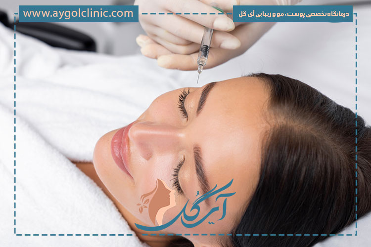 بوتاکس نابوتا روشی ایمن و موثر برای از بین بردن چینوچروک