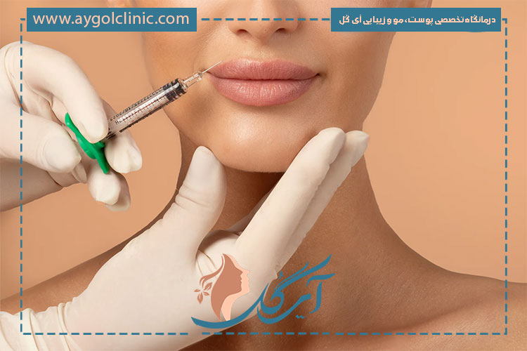 معرفی محبوبترین ژل لب های کره ای با قیمت مناسب و ایمنی بالا