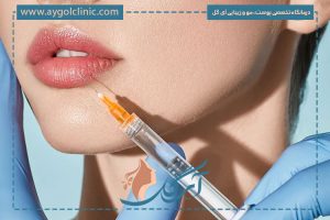 ماندگاری ژل لب نورامیس؛ بررسی کامل عوامل و مزایا