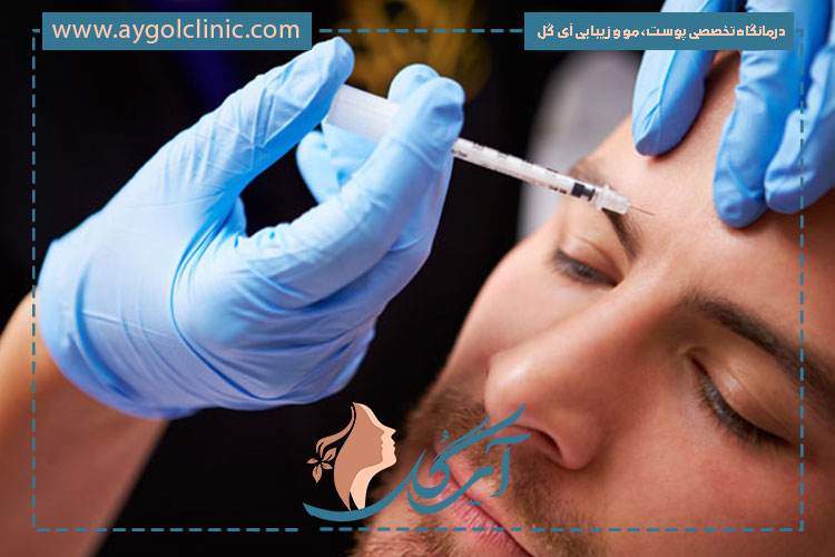 ماندگاری بوتاکس دیستون چه مدت است و به چه عواملی بستگی دارد؟