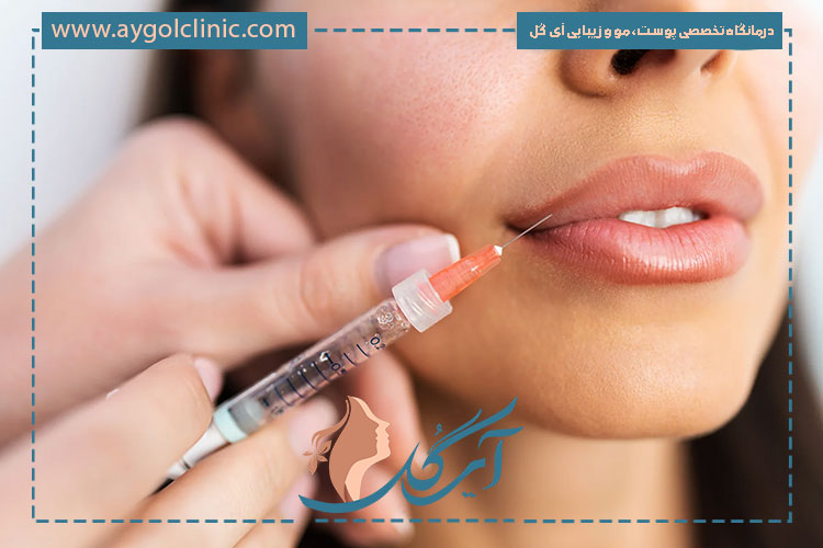 ژل لب نورامیس؛ انتخابی مقرونبهصرفه با نتایج طبیعی و رضایت بالا