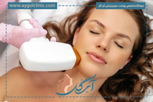 مراقبت های بعد از لیزر co2 | فواید، عوارض و نکات مهم